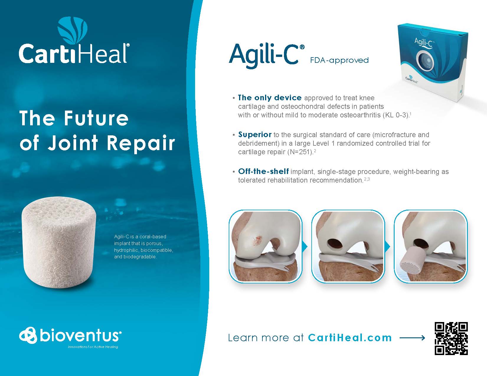 Cartilage Restoration Ankle Knee Elbow Shoulder